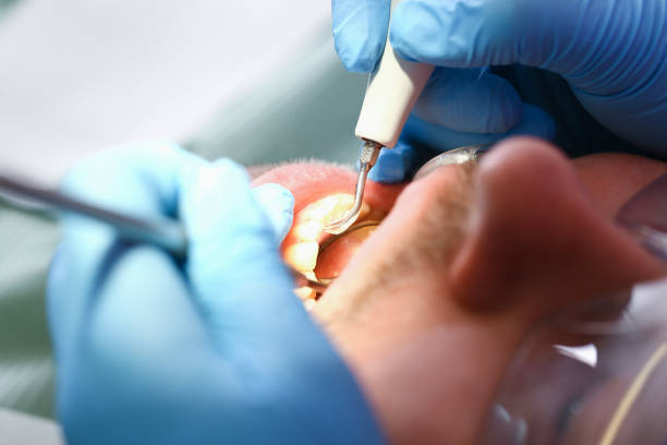 Best Emergency Dentist for Lost Fillings or Crowns in Tieton, WA
